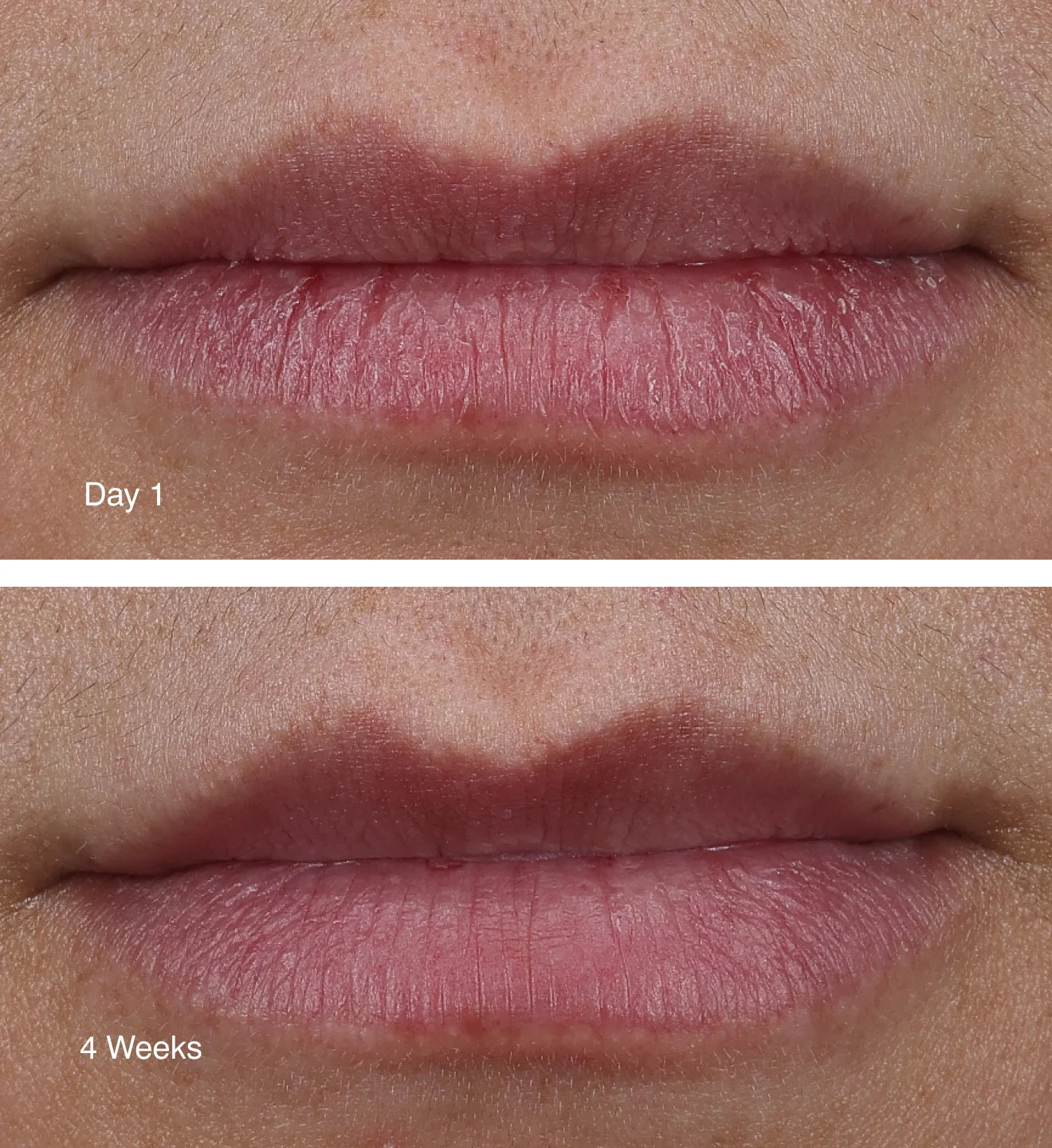 rhode - Peptide Lip Treatment Nourishing Glaze 10mL