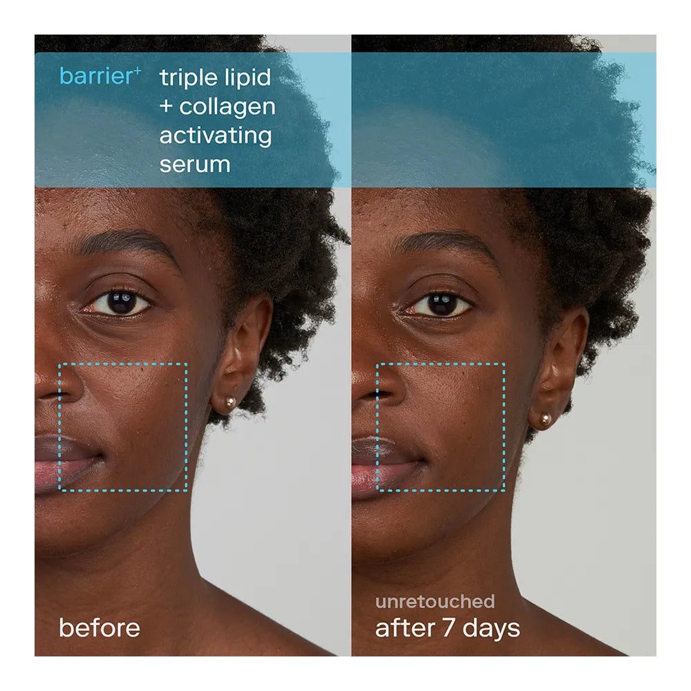 Skinfix - Barrier+ Mini Bestsellers Kit