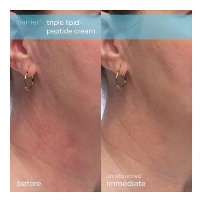 Skinfix - Barrier+ Mini Bestsellers Kit